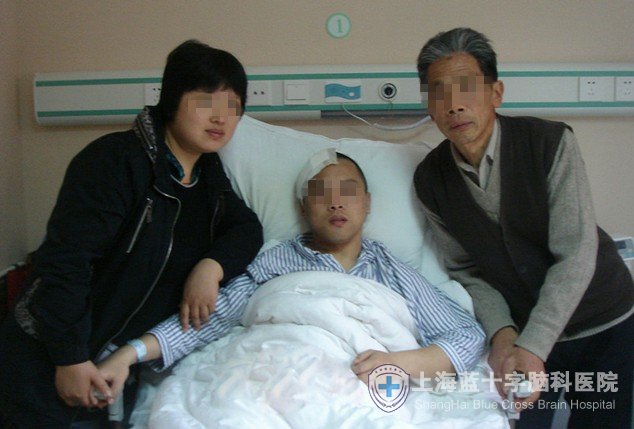 右额叶深部巨大胶质瘤在上海蓝十字获成功切除